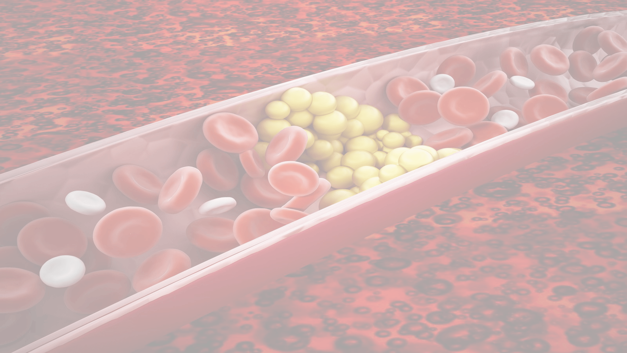 high-triglycerides-real-condition-or-false-diagnosis-sruk-ceru